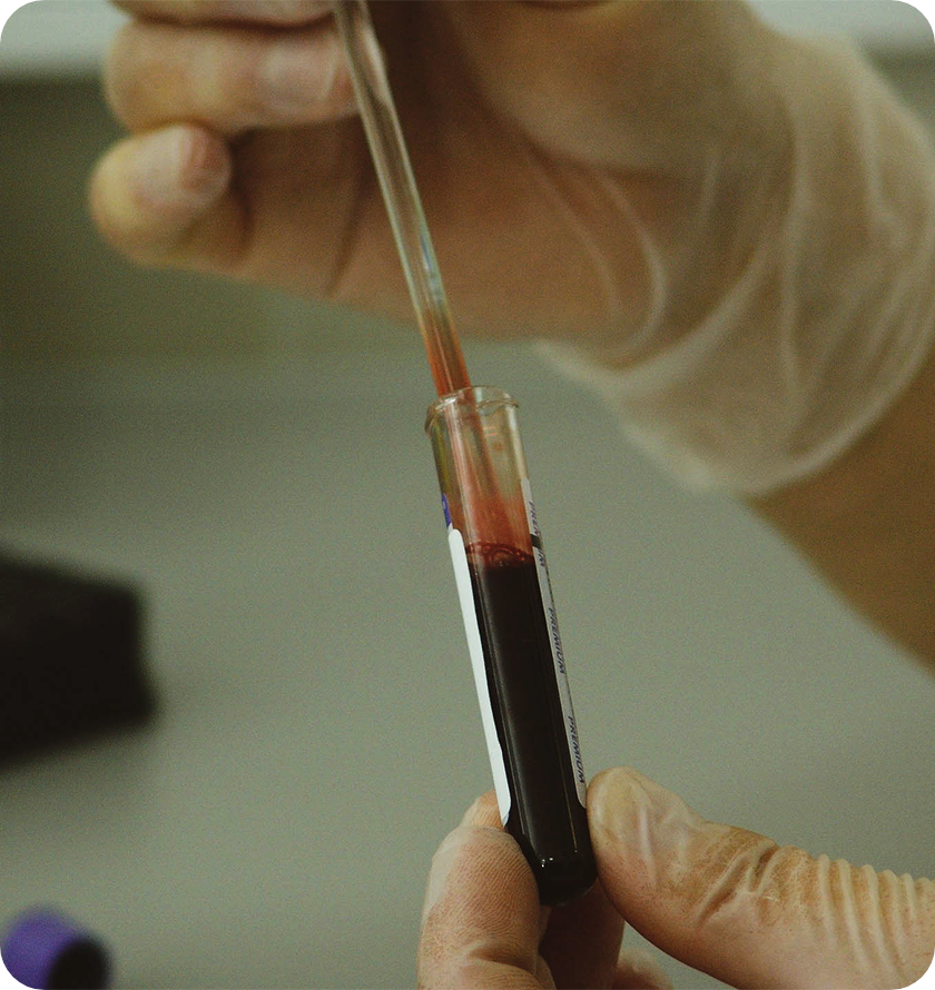 Prueba-Prenatal-No-Invasiva